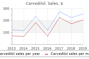 buy cheap carvedilol 12.5mg on-line