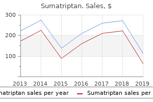 sumatriptan 100mg lowest price