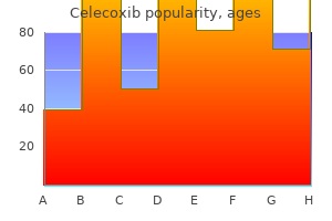 buy discount celecoxib 200 mg on-line