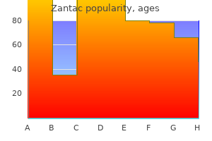 buy cheap zantac 150 mg online