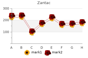 cheap zantac 150mg without prescription