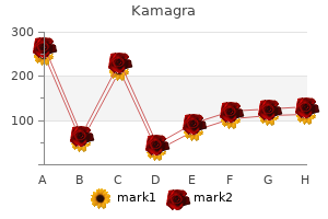 kamagra 50mg online